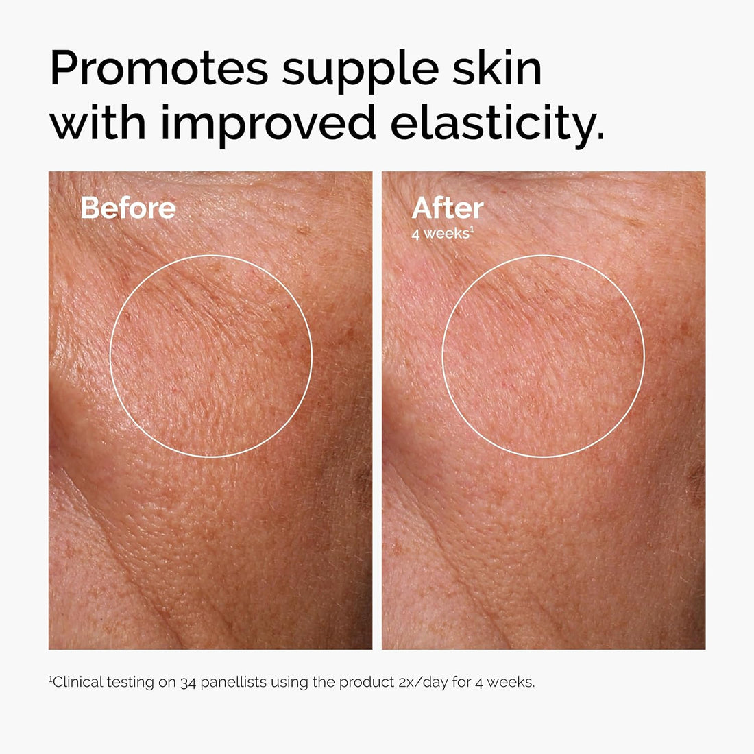 The Ordinary Hyaloronic acid Serum 30ml