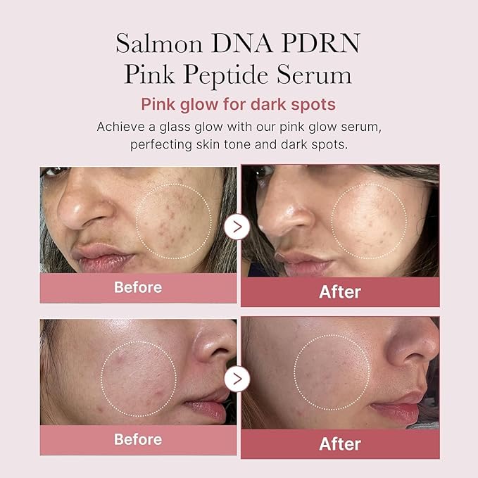 medicube - PDRN Pink Peptide Serum 30 ml